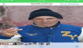 خطير.. مستشفى الدراق ببركان يرفض تقديم المساعدة الطبية الإستعجالية لمواطن مسن يعاني من تقيّح أطرفه وتورّمها ..”صور بشعة”