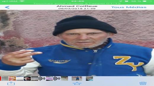 خطير.. مستشفى الدراق ببركان يرفض تقديم المساعدة الطبية الإستعجالية لمواطن مسن يعاني من تقيّح أطرفه وتورّمها ..”صور بشعة”