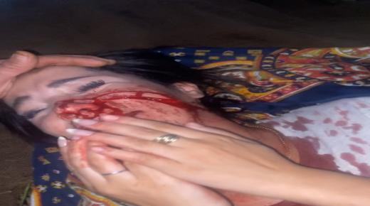 خولة… حين تُشرمَل طفلة في وجدة..مدينة تدفع فاتورة استجابة أمنٍية أدنى من حجم الأخطار..