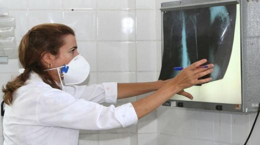 خطير..وزارة الصحة تعلن عن اصابة 30 الف مواطن مغربي بداء السل