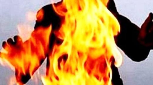 أربعينية تضرم النار في زوجها بسبب السحر والخيانة