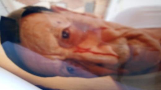 وجدة..عاجل إلى من يهمّهم الأمر..عاجوز(86سنة) يتعرّض للضرب والجرح الخطير والجاني حرّ طليق مدّعيا أن نفوذه لا يُقهر..