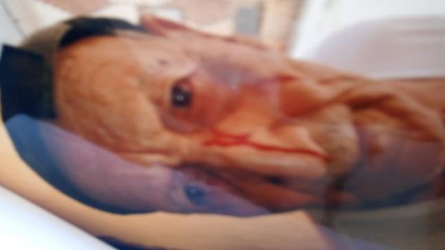 وجدة..عاجل إلى من يهمّهم الأمر..عاجوز(86سنة) يتعرّض للضرب والجرح الخطير والجاني حرّ طليق مدّعيا أن نفوذه لا يُقهر..