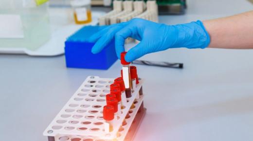 ما العلاقة بين أمراض خطيرة ونوع فصيلة الدم؟