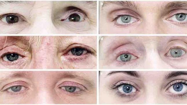 علماء يخترعون عيناً صناعية خارقة بواسطة الطباعة ثلاثية الأبعاد￼