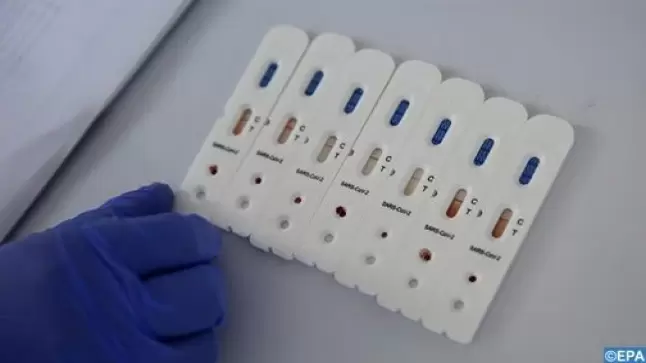 فرنسا.. انتعاش الإصابات بكوفيد عشية الألعاب الأولمبية