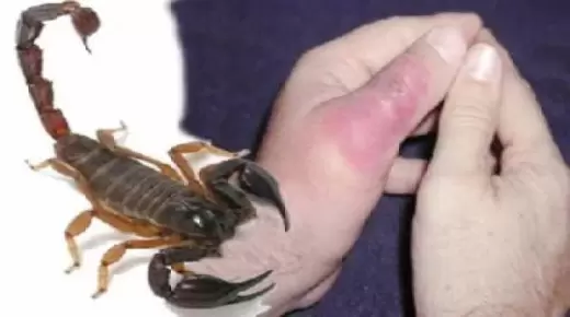 المطالبة بتوفير المعدات الطبية والأدوية والتركيبات بكميات كافية داخل المستشفيات المغربية لمقاومة لسعات العقارب ولدغات الأفاعي ..