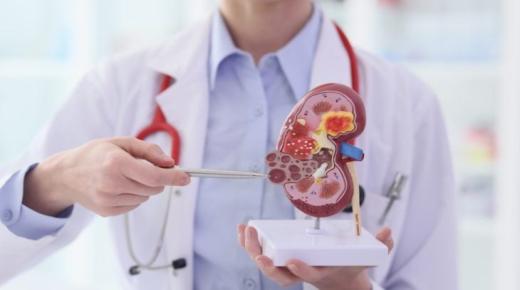 دراسة: أمراض الكلى المزمنة تاسع أبرز سبب للوفاة على مستوى العالم