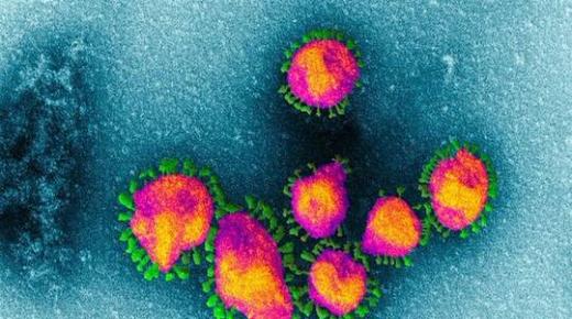 الآثار الوخيمة التي يخلفها فيروس كورونا في جسم الإنسان حتى بعد الشفاء منه!