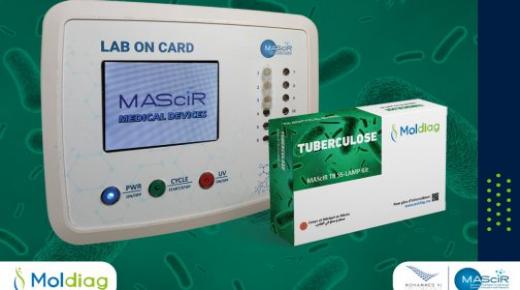 إطلاق أول اختبار تشخيصي لداء السل، مغربي الصنع 100 بالمائة..