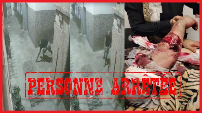 الشرطة تعتقل معتدياً استعمل سلاحاً أبيض ضد جاره وزوجته..