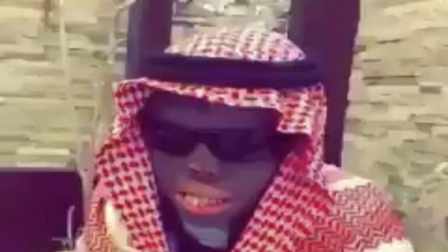 رحيل “القتيل الحي” بعد معاناة دامت 15 عاما مع الحروق