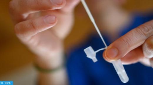 اختبار (بي سي إر) يظل الآلية الناجعة لتشخيص الإصابة بـ (كوفيد-19)..