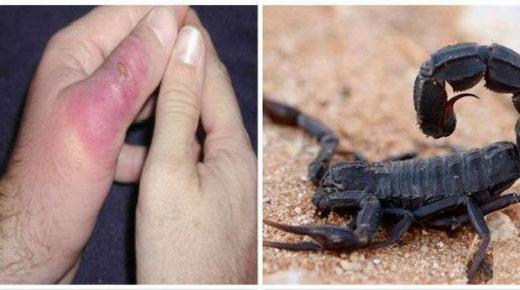 وزارة الصحة تحذر من خطورة لسعات العقارب ولدغات الأفاعي..