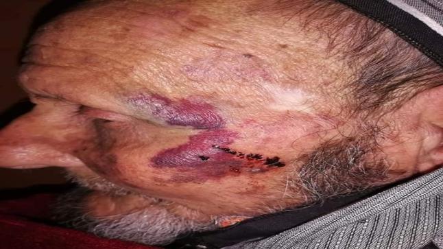 ببشاعة ووحشية عون سلطة يعتدي على مسنّ ” 96 سنة” طالب بالإستفادة من دعم صندوق كورونا