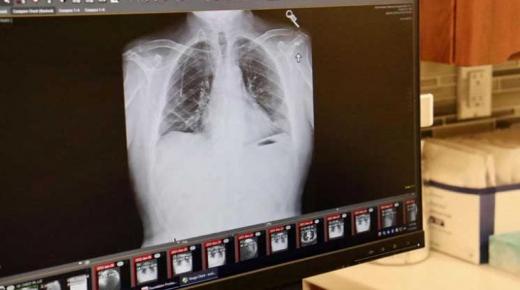 دواء يقلّص إلى النصف خطر الوفاة الناجمة عن الإصابة بأحد أنواع سرطان الرئة..