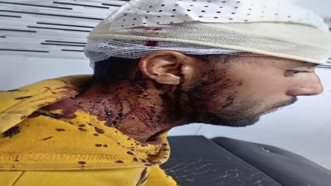 لصوص بدراجة نارية ينفذون جريمة خطيرة بالسيوف في حقّ حارس ليلي بحي “النيلو” بوجدة..؟؟