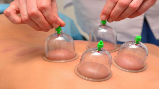 فعاليات حقوقية تدق ناقوس الخطر إزاء تفشي محلات للحجامة في ظروف تضرّ بصحّة المواطنين..