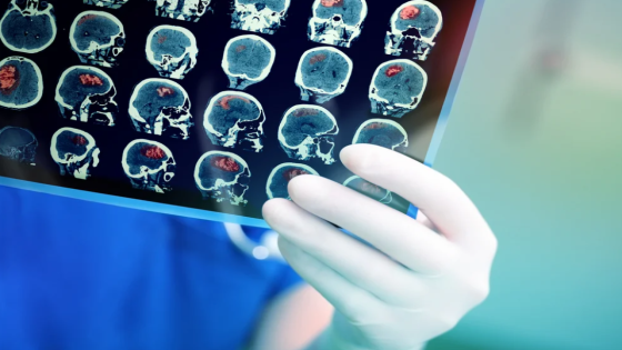 وثيقة سرية عمرها 75 عاماً تتضمن علاجاً للسرطان.. هل أخفاها الأمريكيون عمداً؟
