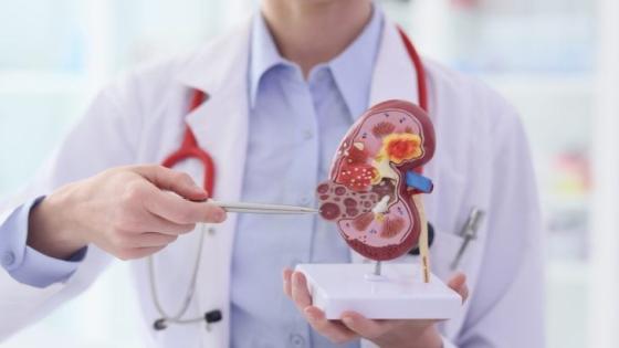 دراسة: أمراض الكلى المزمنة تاسع أبرز سبب للوفاة على مستوى العالم